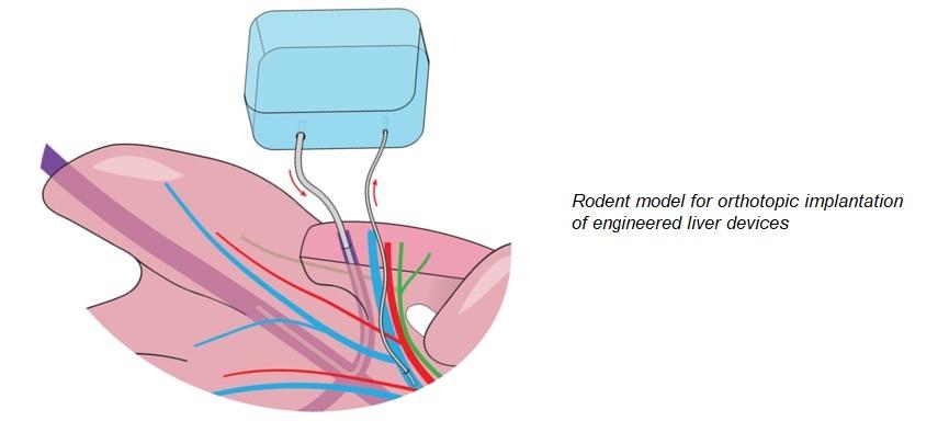 Rodent Model for Orthotopic Implantation of Engineered Liver Devices