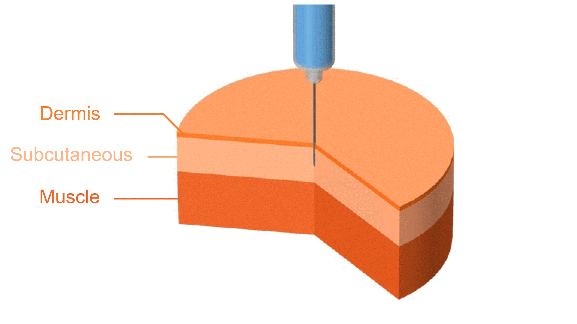 CFD simulation of subsutaneous injection