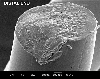 SEM of Fractured Catheter 1000x