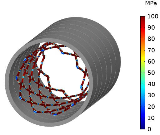 Stent Model Expansion