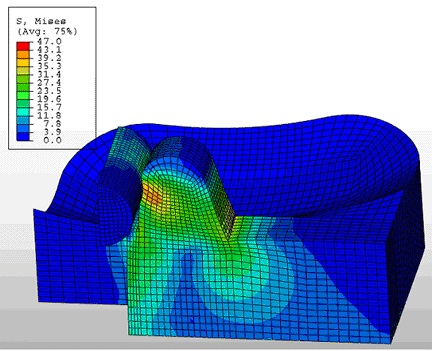 Total Knee Replacement Simulation