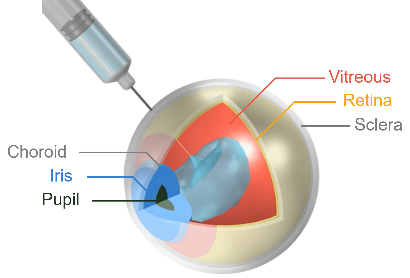 CFD simulation of intravitreal ocular injection