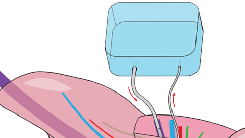 Rodent Model for Orthotopic Implantation of Engineered Liver Devices