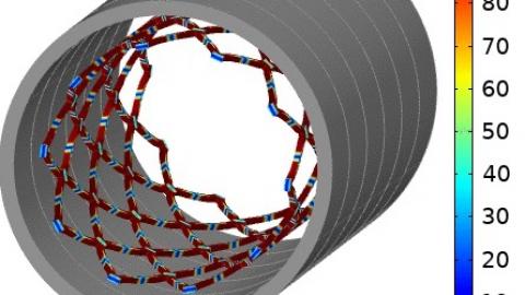 Stent Model Expansion