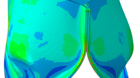 Stress field for a FEA simulation of a heart valve