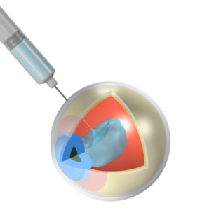 Simulation of intravitreal injection